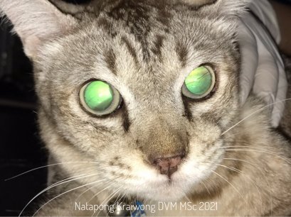 ความดันโลหิตสูงกับตาบอดเฉียบพลัน
